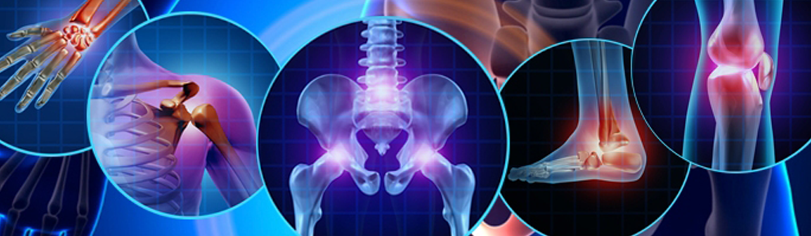 Joint Replacements | Processall